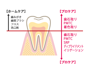 ホームケアとプロケア