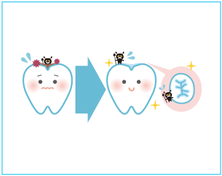 シーラント処理した歯のイラスト