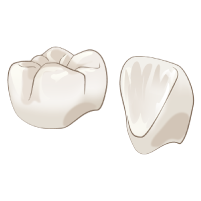 ジルコニアクラウンのイラスト