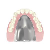 金属床入れ歯のイラスト